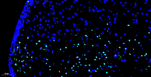 Fluorescein (FITC) TUNELL ZELLEN APOPTOSE Detektion Kit 500T für Paraffinabschnitt Gefrorene Abschnitt Zellen Slide Zellenabstrich