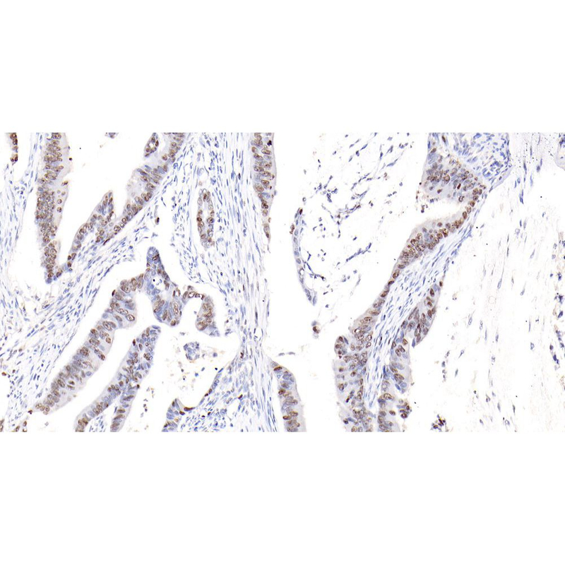 Anti -ki67-Kaninchen-PAB für Krebsforschung IHC, wenn primärer Antikörper