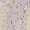 Anti -Gap43 Kaninchen PAB Neurodeveloplemental Immunblotting