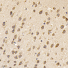 GB11144 Anti -nmdar1 Kaninchen Antikörper PAB