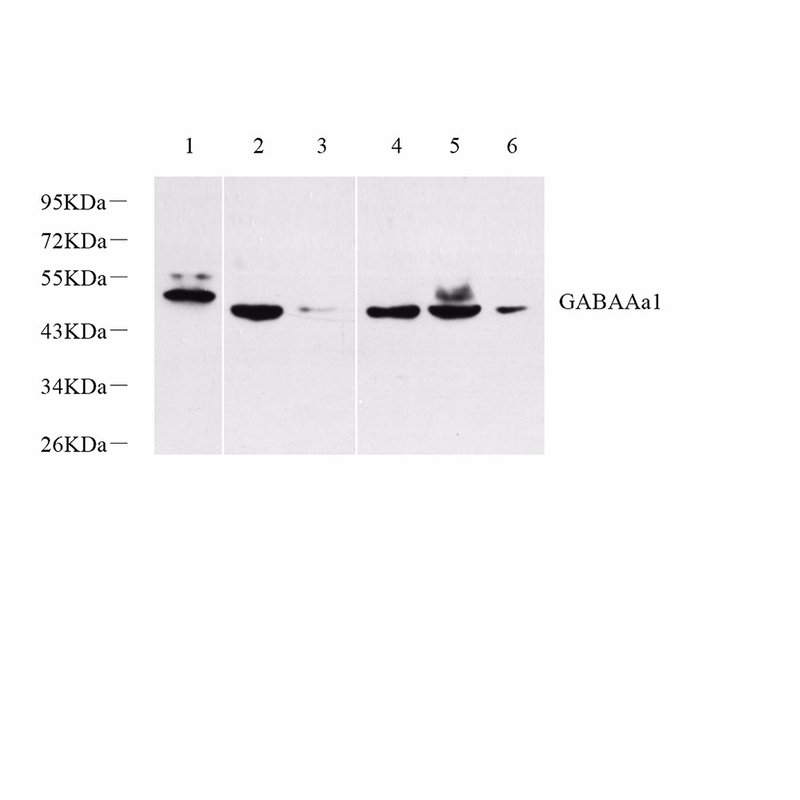 GB11402 Antikörper-Gaba A-Rezeptor-Alpha 1 (GABAAA1) Kaninchen-PAB-Western-Blot-Antikörper